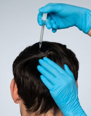 Medicina Capilar 2 Tratamientos de medicina estética capilar en Huelva_2