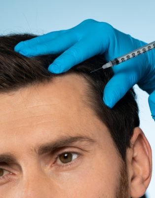 Medicina Capilar 4 Tratamientos de medicina estética capilar en Huelva_4